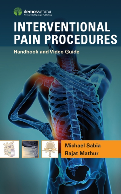Libro electrónico Interventional Pain Procedures MD Michael Sabia