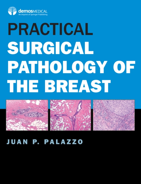 E-kniha Practical Surgical Pathology of the Breast MD Juan P. Palazzo