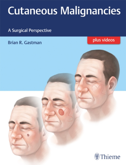E-kniha Cutaneous Malignancies Brian Gastman
