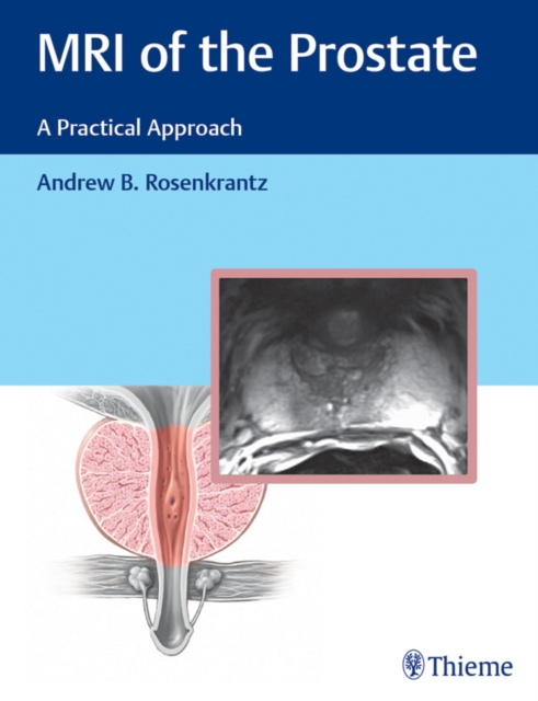 E-kniha MRI of the Prostate Andrew B. Rosenkrantz