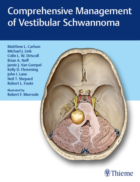 E-kniha Comprehensive Management of Vestibular Schwannoma Matthew L. Carlson