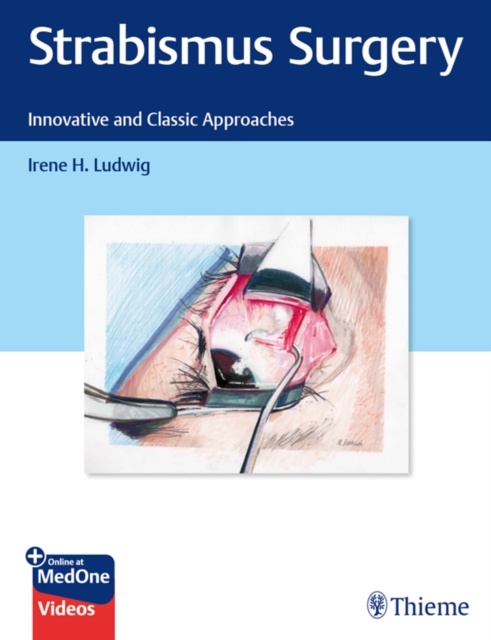 E-kniha Strabismus Surgery Irene H. Ludwig