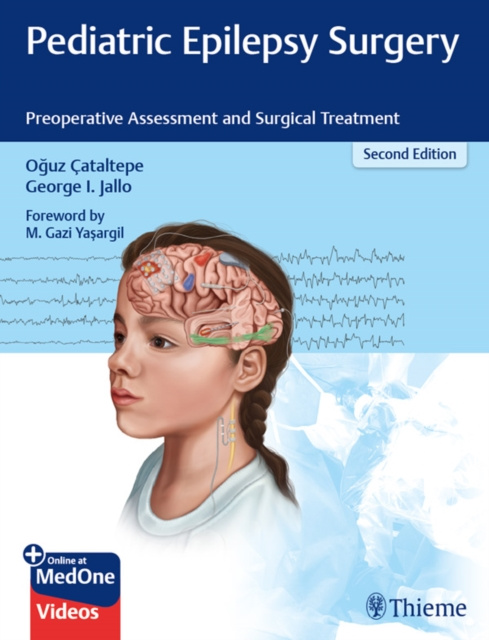 E-kniha Pediatric Epilepsy Surgery Oguz Cataltepe
