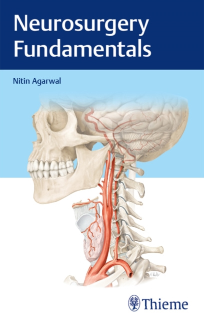 E-kniha Neurosurgery Fundamentals Nitin Agarwal