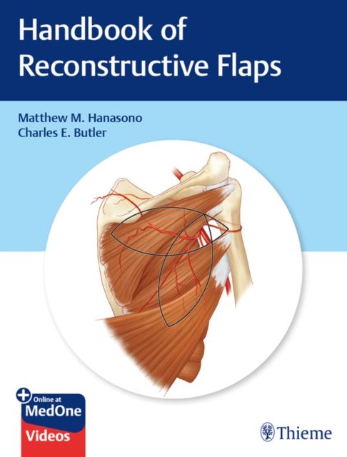 E-kniha Handbook of Reconstructive Flaps Matthew M. Hanasono