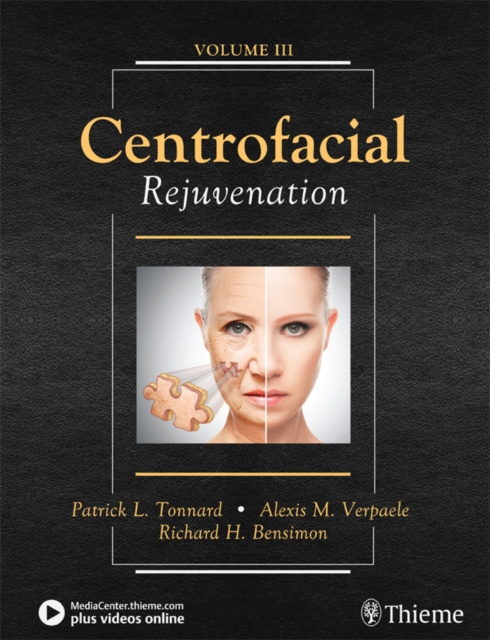 E-kniha Centrofacial Rejuvenation Patrick Tonnard