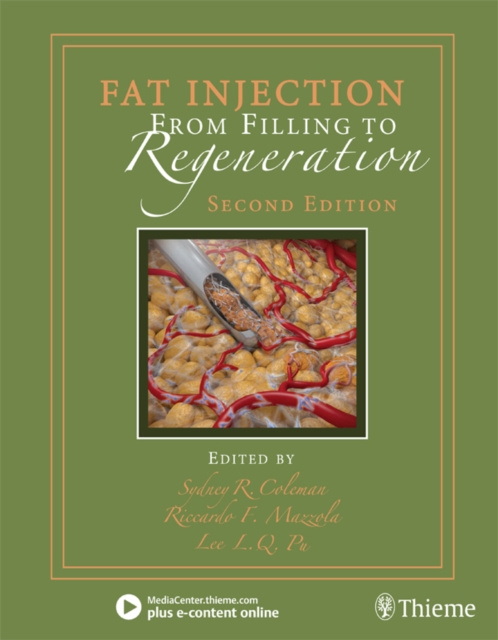 E-kniha Fat Injection Sydney R. Coleman
