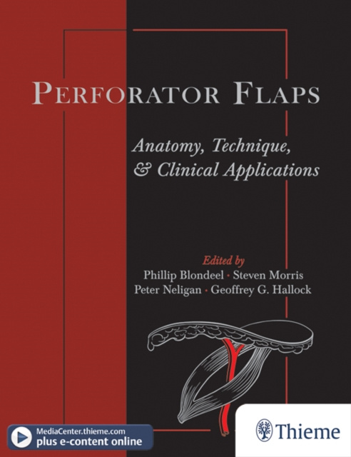 E-book Perforator Flaps Phillip Blondeel