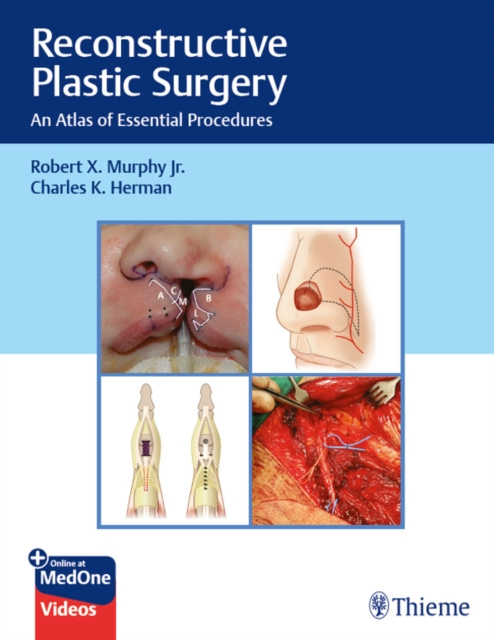 E-book Reconstructive Plastic Surgery Robert X. Murphy Jr.