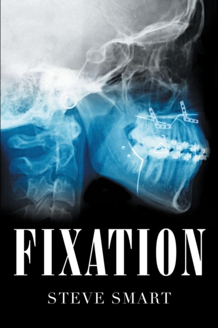 E-knjiga Fixation Steve Smart