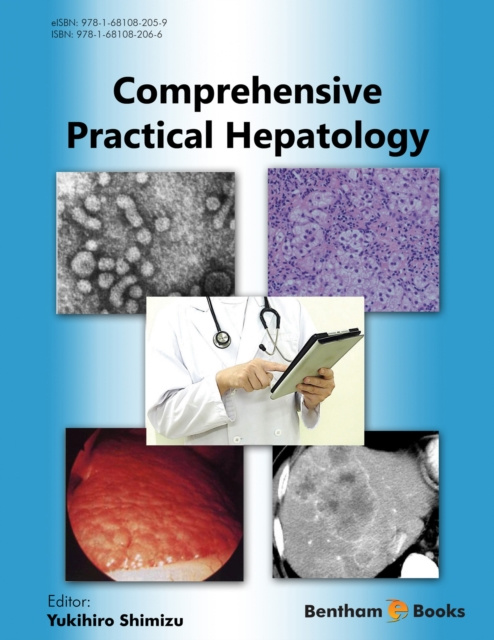 E-knjiga Comprehensive Practical Hepatology Yukihiro Shimizu