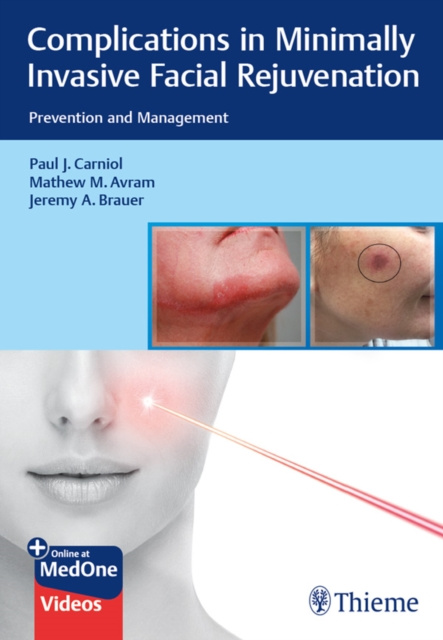 E-kniha Complications in Minimally Invasive Facial Rejuvenation Paul J. Carniol