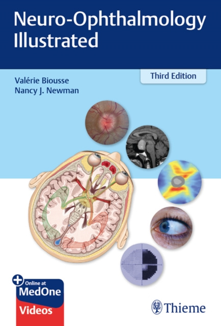 E-kniha Neuro-Ophthalmology Illustrated Valerie Biousse