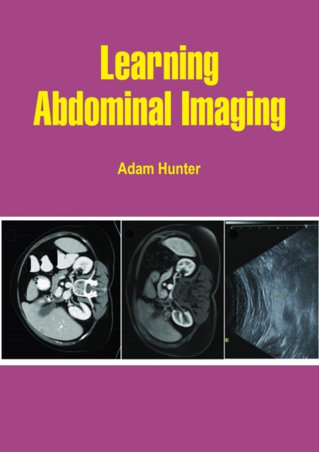 E-book Learning Abdominal Imaging Adam Hunter