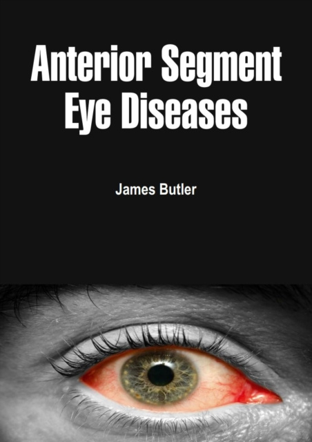 E-knjiga Anterior Segment Eye Diseases James Butler