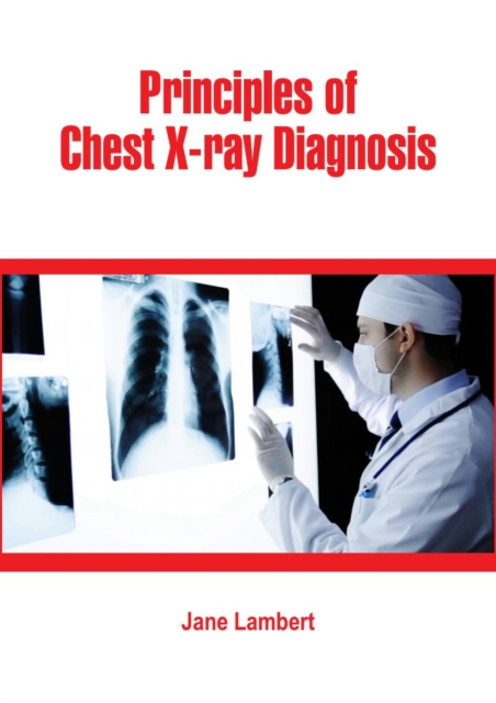 E-knjiga Principles of Chest X-ray Diagnosis Jane Lambert