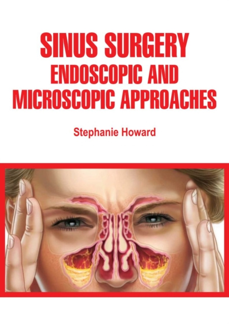 E-knjiga Sinus Surgery Stephanie Howard
