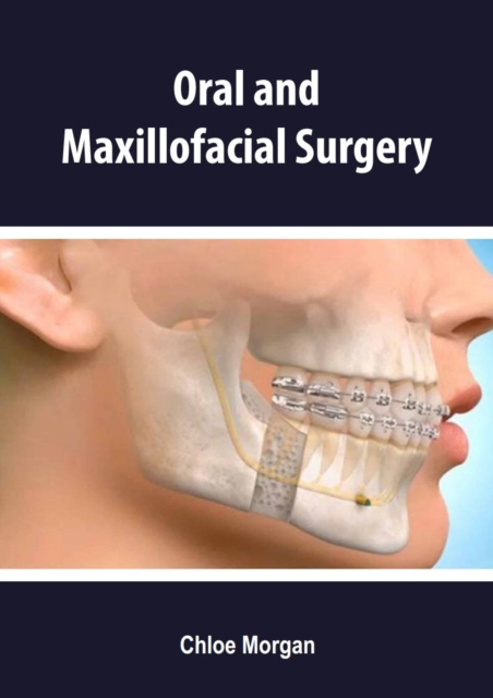 E-book Oral and Maxillofacial Surgery Chloe Morgan