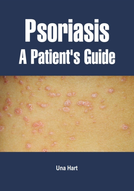 E-knjiga Psoriasis Una Hart