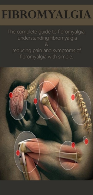 E-book Fibromyalgia David Anthony