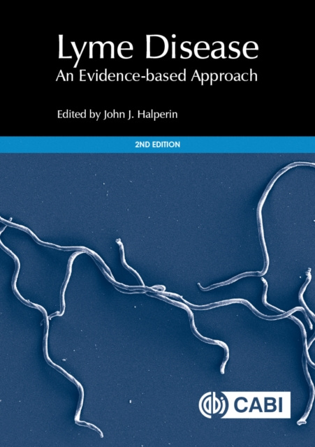 E-Book Lyme Disease John J Halperin