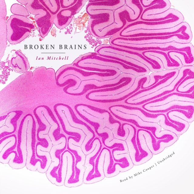 Audiobook Broken Brains Ian Mitchell