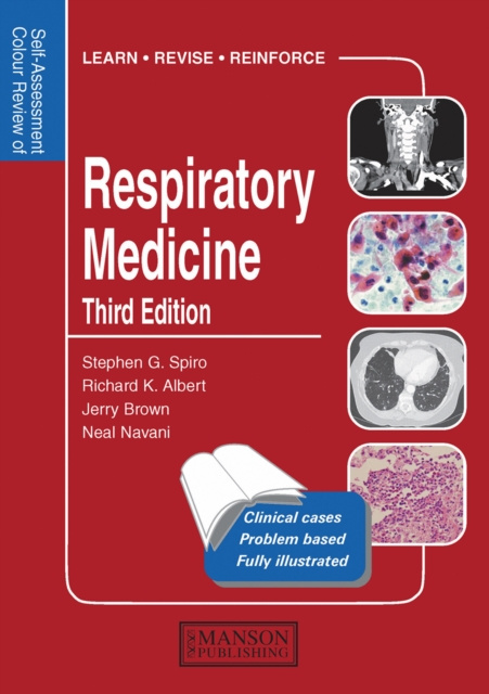 E-book Respiratory Medicine Stephen Spiro