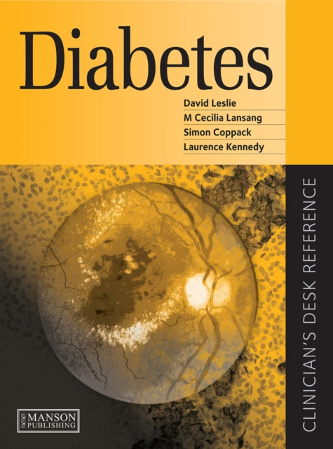 E-kniha Diabetes David Leslie