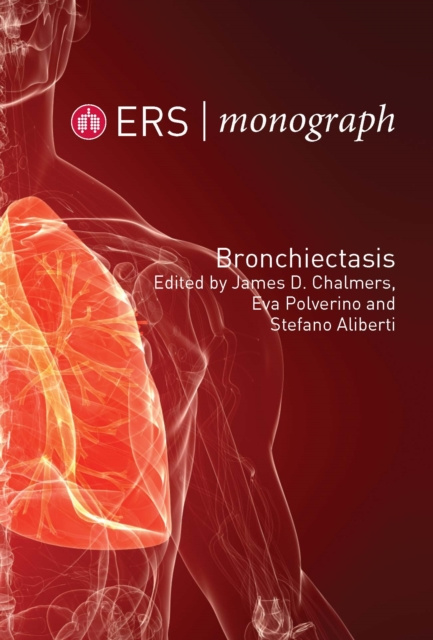 E-knjiga Bronchiectasis James D Chalmers