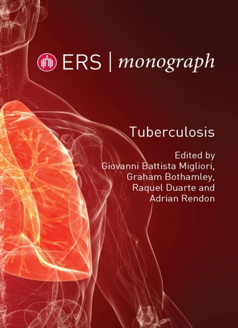 E-knjiga Tuberculosis Giovanni Battista Migliori