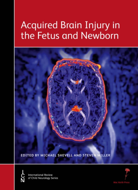 E-kniha Acquired Brain Injury in the Fetus and Newborn Michael Shevell