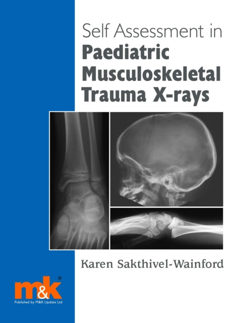 E-book Self-assessment in Paediatric Musculoskeletal Trauma X-rays Karen Sakthivel-Wainford