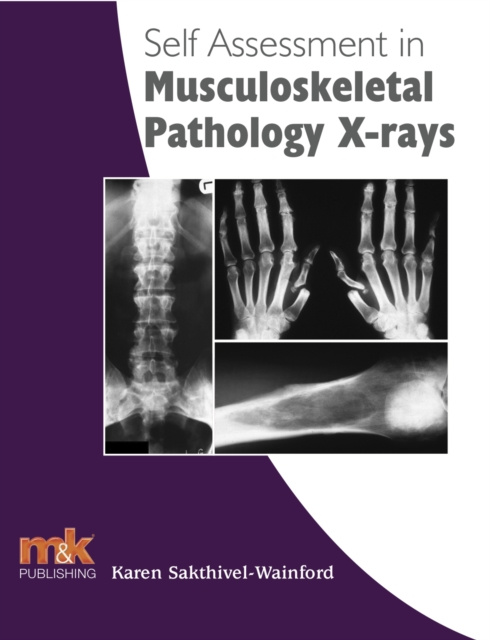 E-kniha Self Assessment in Musculoskeletal Pathology X-rays Karen Sakthivel Wainford