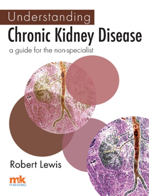 Libro electrónico Understanding Chronic Kidney Disease Dr Robert Lewis