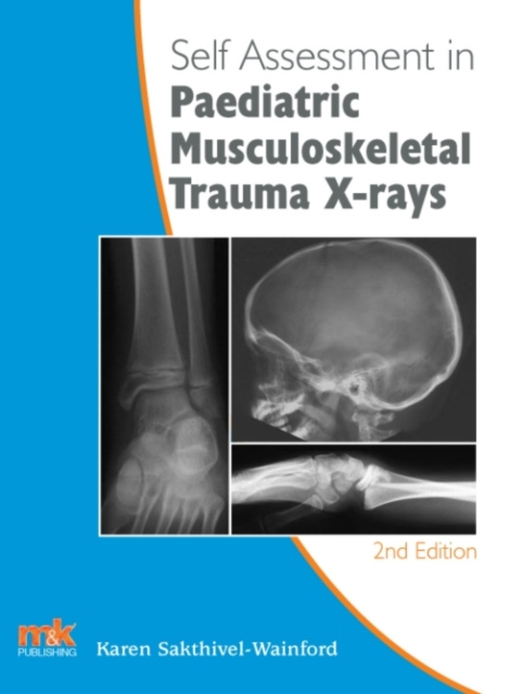 E-book Self-assessment in Paediatric Musculoskeletal Trauma X-rays Karen Sakthivel-Wainford