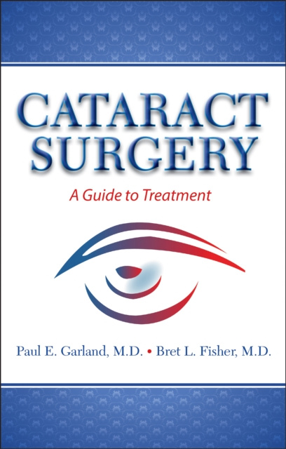 E-Book Cataract Surgery Bret L Fisher