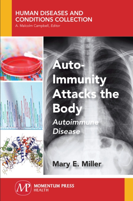 E-knjiga Auto-Immunity Attacks the Body Mary E. Miller