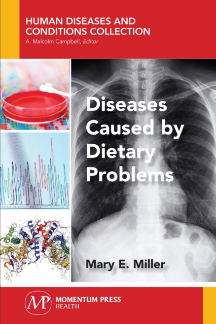 E-kniha Diseases Caused by Dietary Problems Mary E. Miller