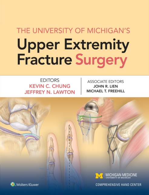 E-kniha University of Michigan's Upper Extremity Fracture Surgery Kevin Chung