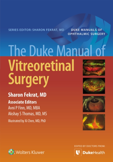 E-book Duke Manual of Vitreoretinal Surgery Sharon Fekrat