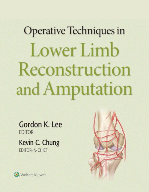 E-kniha Operative Techniques in Lower Limb Reconstruction and Amputation Kevin Chung