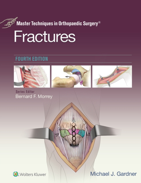 E-knjiga Master Techniques in Orthopaedic Surgery: Fractures Michael J. Gardner