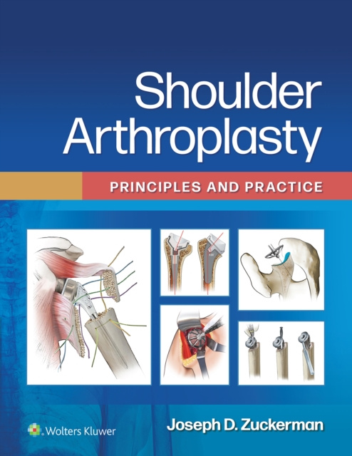 E-knjiga Shoulder Arthroplasty Joseph D. Zuckerman