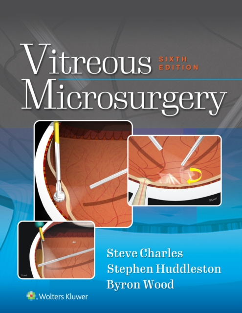 E-Book Vitreous Microsurgery Steve Charles