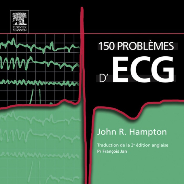 E-kniha 150 problemes d'ECG John R. Hampton