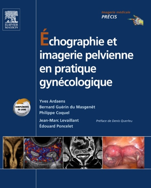 E-kniha Echographie et imagerie pelvienne en pratique gynecologique Yves Ardaens