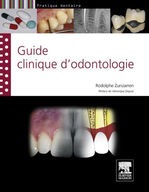 E-kniha Guide clinique d'odontologie Rodolphe Zunzarren
