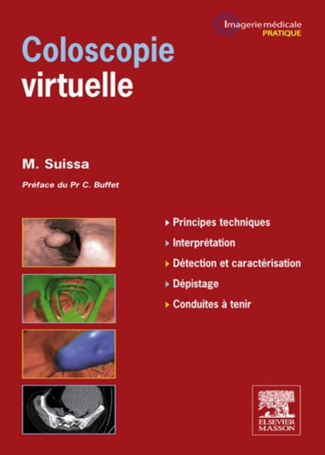 E-kniha Coloscopie virtuelle Mickael Suissa