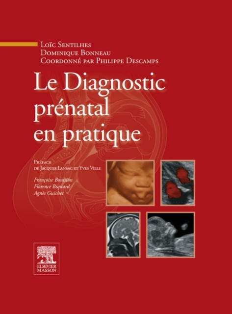 E-kniha Le Diagnostic prenatal en pratique Philippe Descamps