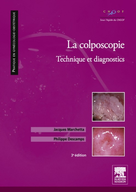 E-kniha La colposcopie Jacques Marchetta